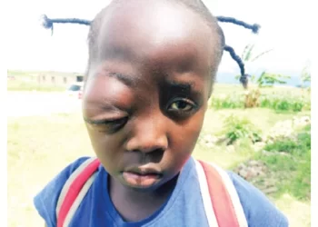 Mother seeks funds for child op in India