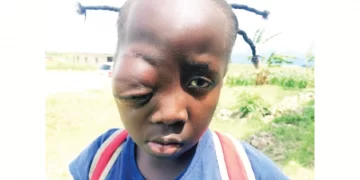 Mother seeks funds for child op in India