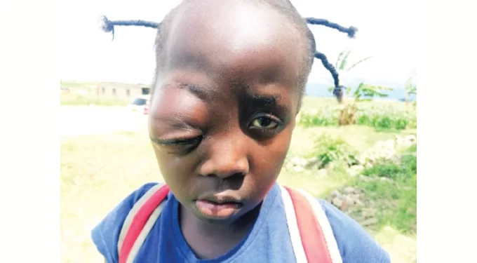 Mother seeks funds for child op in India