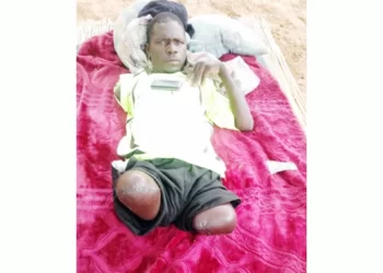 Victim of crocodile attack agony continues
