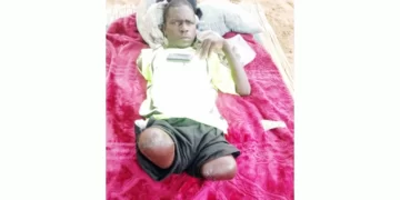 Victim of crocodile attack agony continues