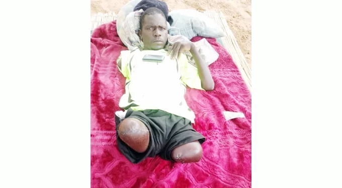 Victim of crocodile attack agony continues