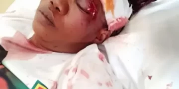 ZANU PF supporters attacked in Gokwe