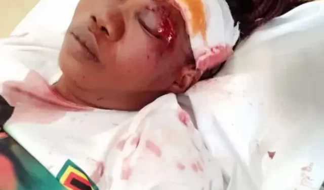 ZANU PF supporters attacked in Gokwe