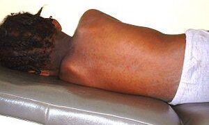 ‘Going against church doctrine saved my children from measles’