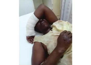 Makokoba sisters survive river monster attack