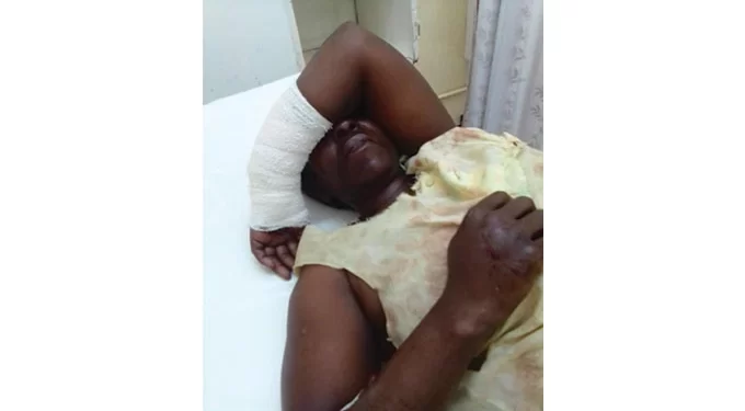 Makokoba sisters survive river monster attack