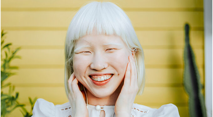 People with albinism appeals for exemption