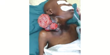 Boy (9) survives deadly cancer after Pari treatment