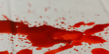 Details emerge on robber found dead near hospital