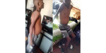 Urgent help sought for heart patient